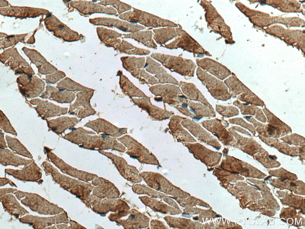 Immunohistochemistry (IHC) staining of mouse heart tissue using Ninein Monoclonal antibody (67132-1-Ig)
