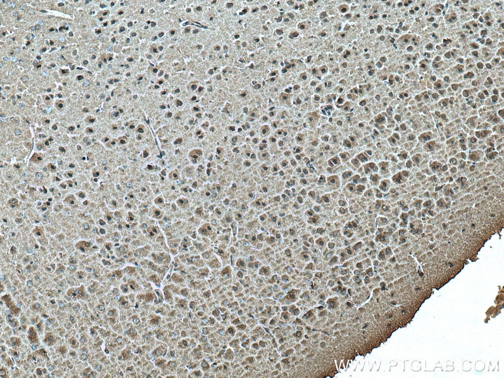 Immunohistochemistry (IHC) staining of mouse brain tissue using Ninein Monoclonal antibody (67132-1-Ig)
