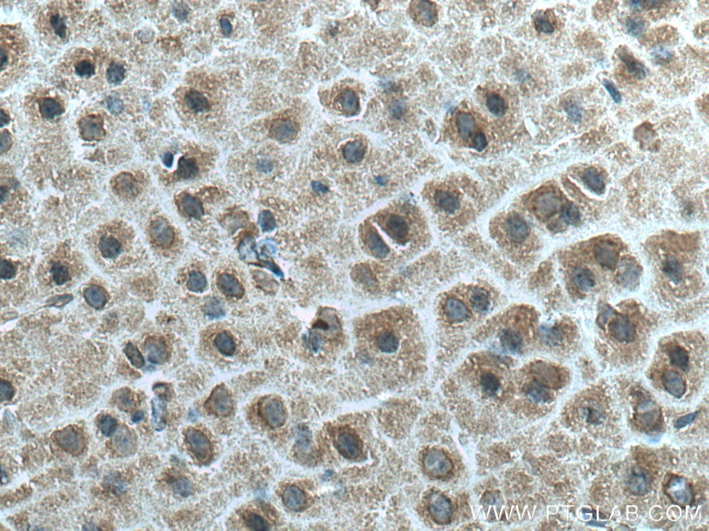 Immunohistochemistry (IHC) staining of mouse brain tissue using Ninein Monoclonal antibody (67132-1-Ig)