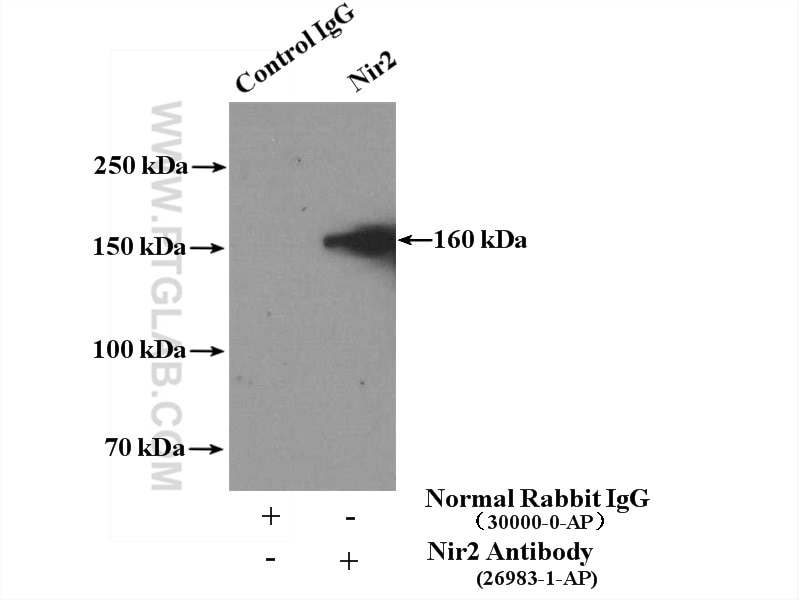 Immunoprecipitation (IP) experiment of HeLa cells using Nir2 Polyclonal antibody (26983-1-AP)