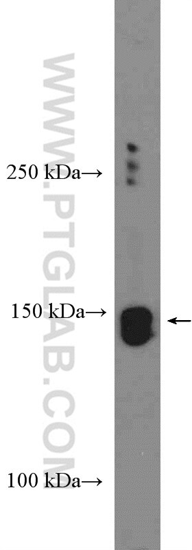 Western Blot (WB) analysis of HepG2 cells using Nir2 Polyclonal antibody (26983-1-AP)
