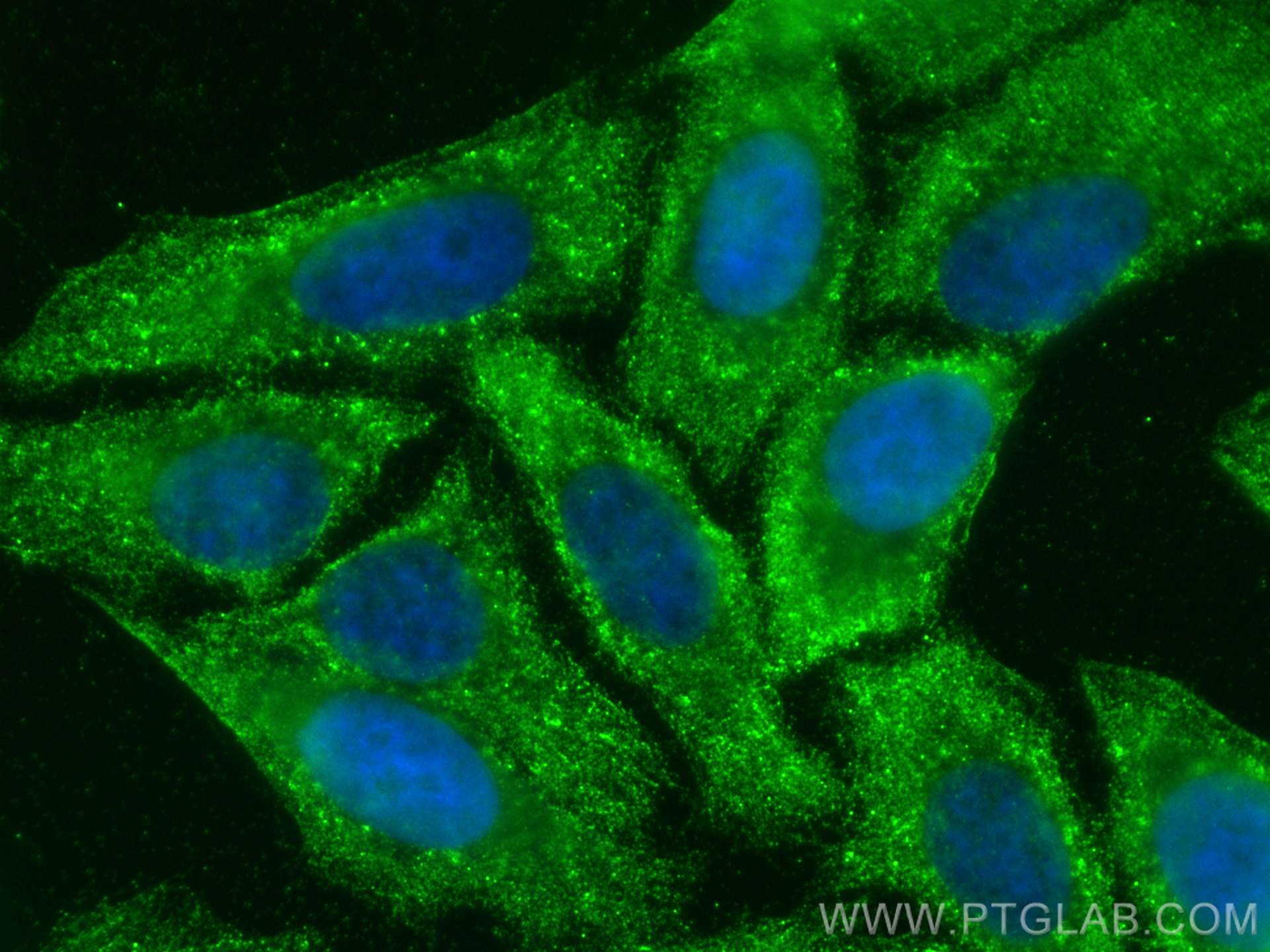 Immunofluorescence (IF) / fluorescent staining of HepG2 cells using Nlrp3/NLRP3 Polyclonal antibody (30109-1-AP)