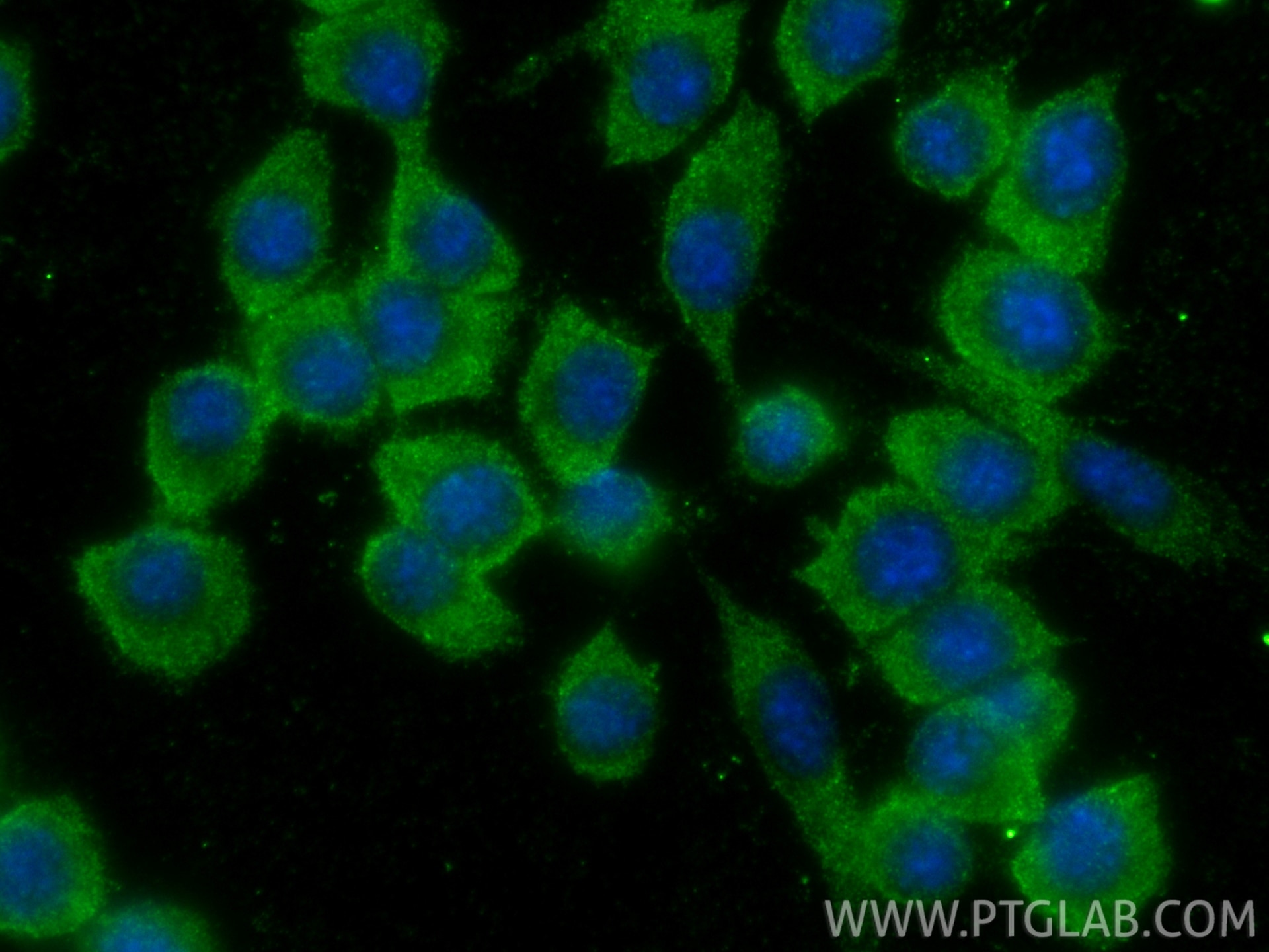 Immunofluorescence (IF) / fluorescent staining of RAW 264.7 cells using NLRP3 Polyclonal antibody (30109-1-AP)