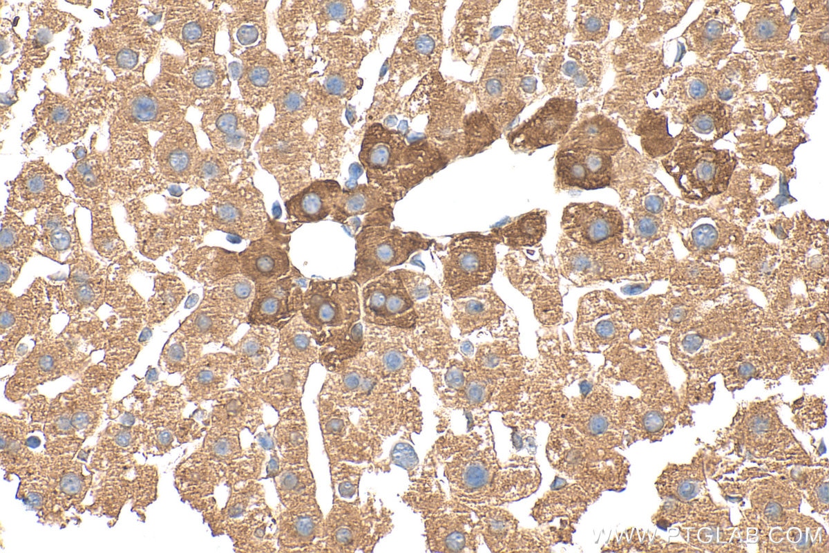 Immunohistochemistry (IHC) staining of mouse liver tissue using NLRP3 Polyclonal antibody (30109-1-AP)