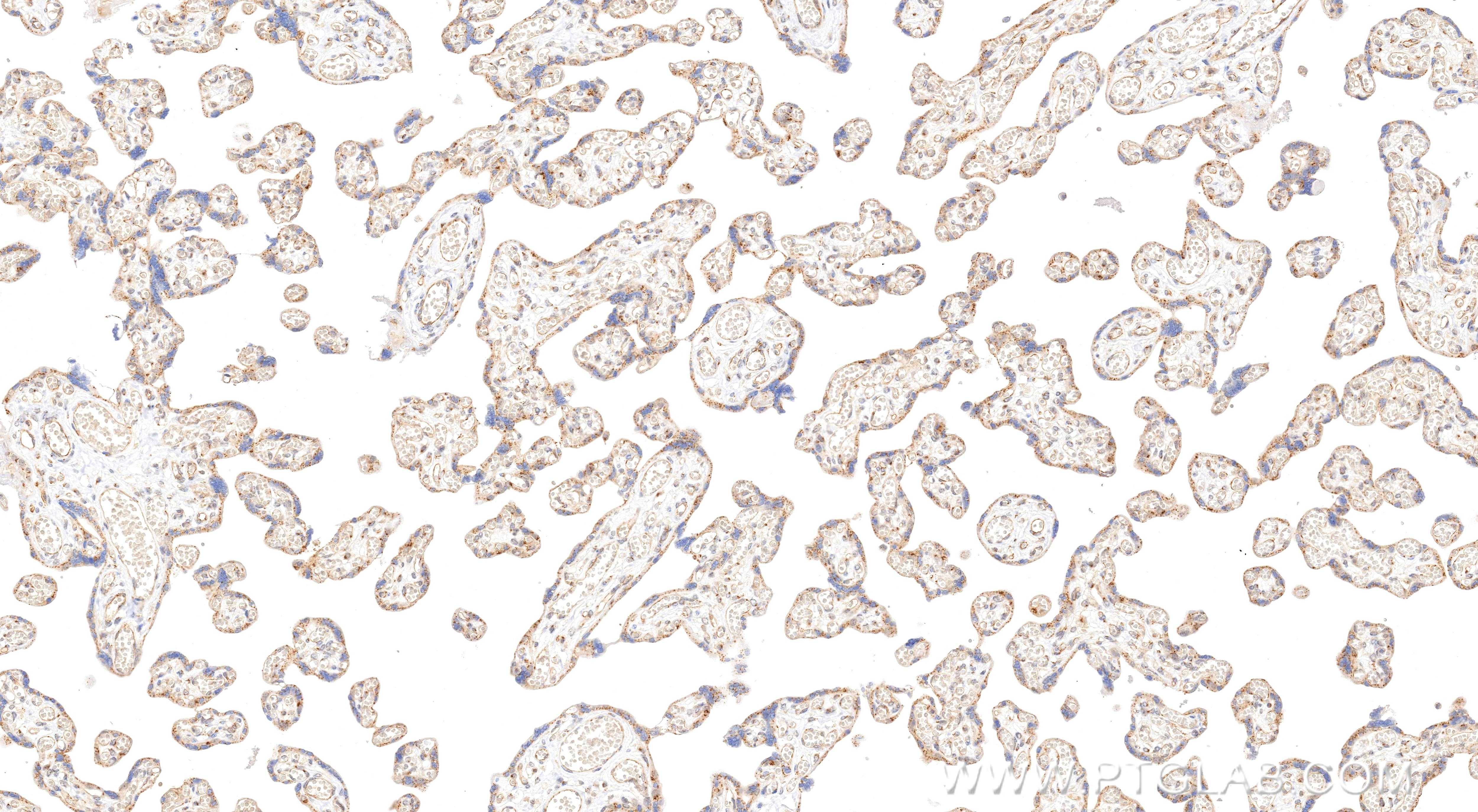 Immunohistochemistry (IHC) staining of human placenta tissue using Noggin Recombinant monoclonal antibody (84283-5-RR)
