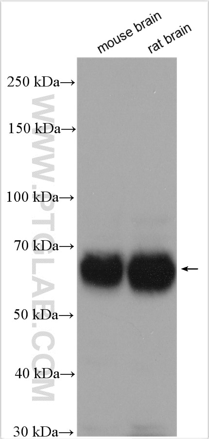 Western Blot (WB) analysis of mouse brain tissue using Nogo receptor/NgR1 Polyclonal antibody (27143-1-AP)