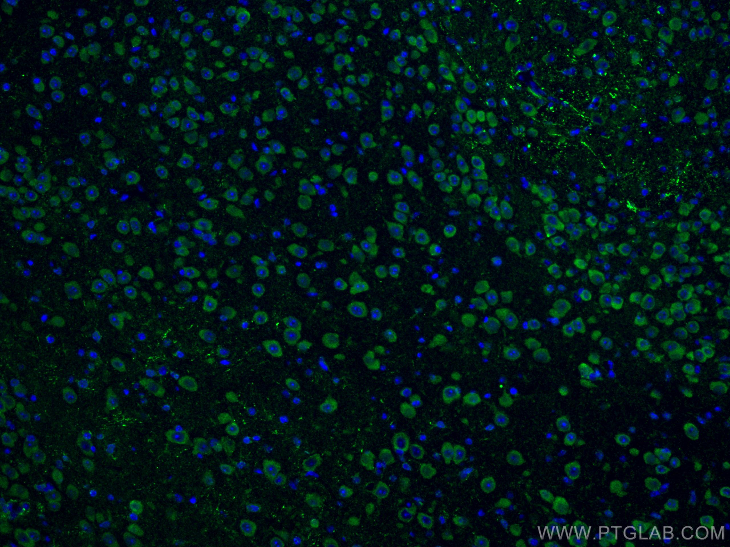 Immunofluorescence (IF) / fluorescent staining of mouse brain tissue using Notch1 Polyclonal antibody (10062-2-AP)