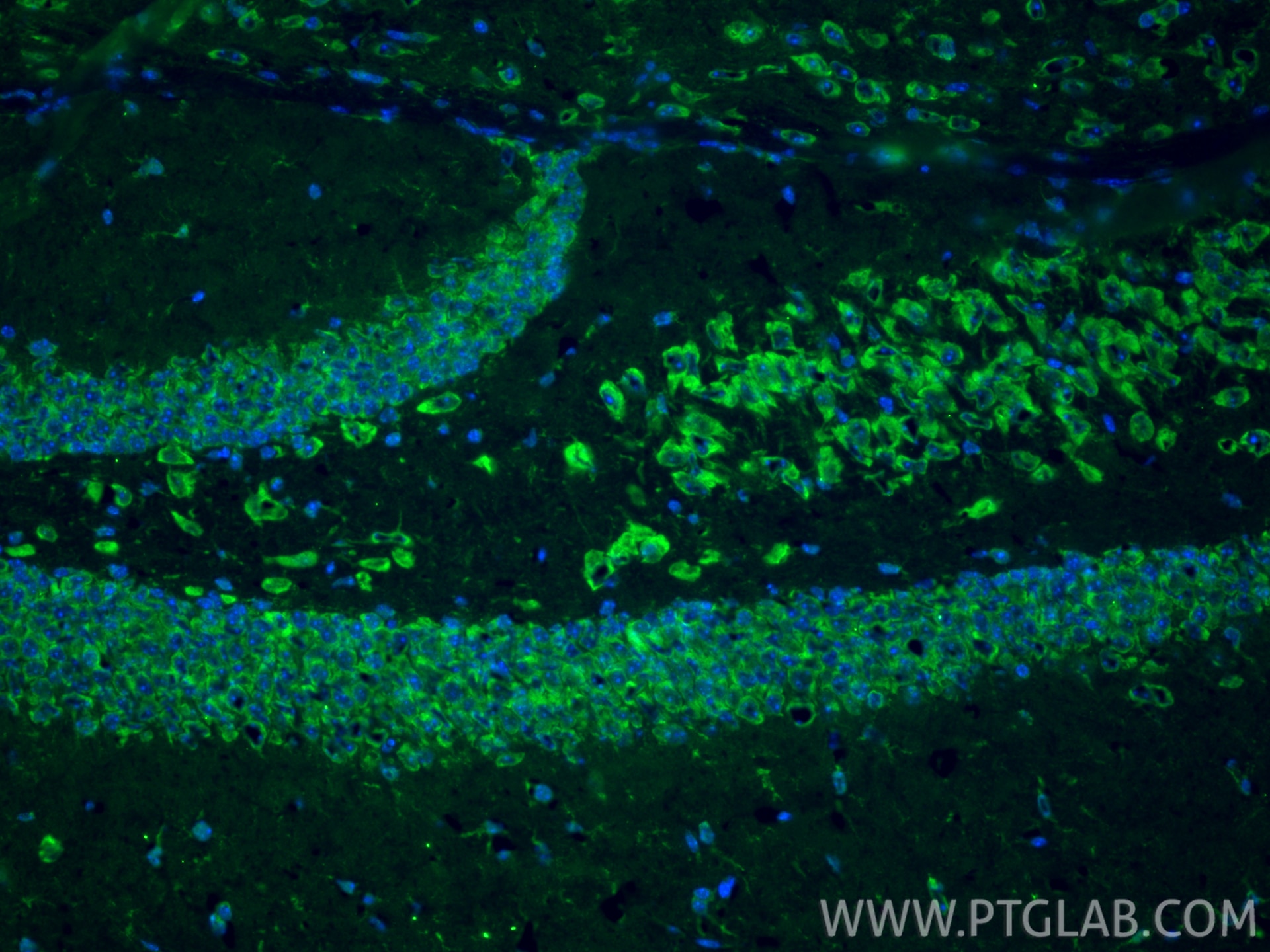 IF Staining of mouse brain using 10062-2-AP Immunofluorescence (IF) / fluorescent staining of mouse brain tissue using Cleaved Notch1 Polyclonal antibody (10062-2-AP)