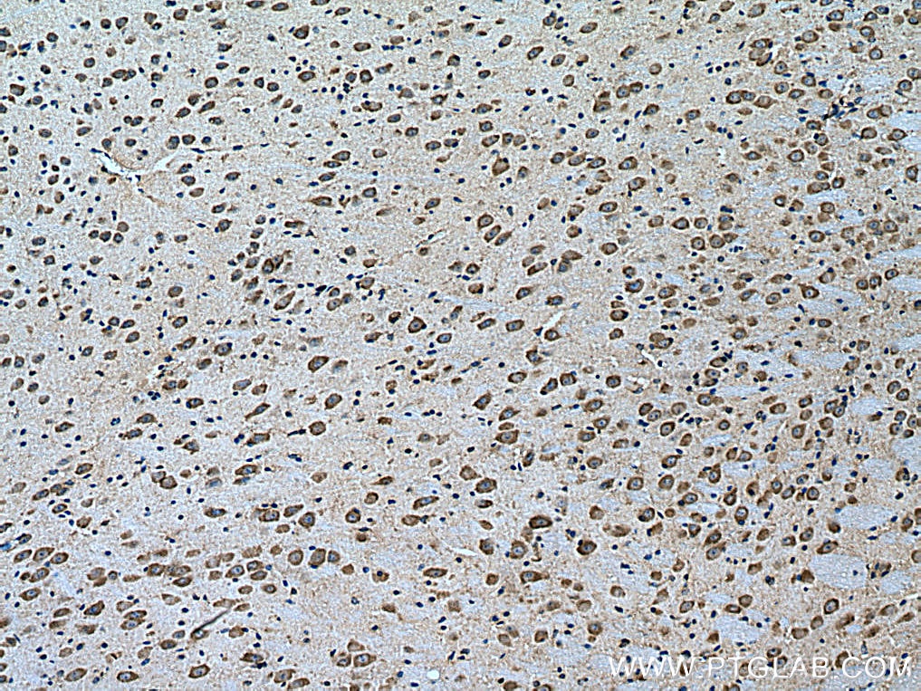 Immunohistochemistry (IHC) staining of mouse brain tissue using Notch1 Polyclonal antibody (10062-2-AP)