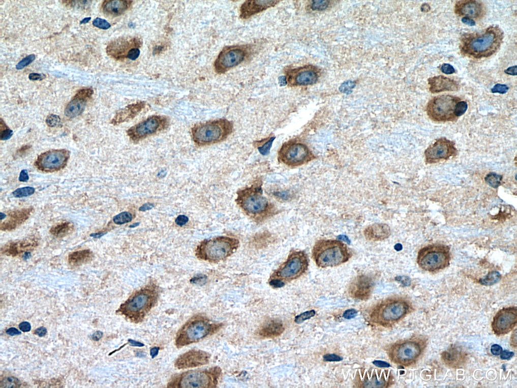 Immunohistochemistry (IHC) staining of mouse brain tissue using Notch1 Polyclonal antibody (10062-2-AP)