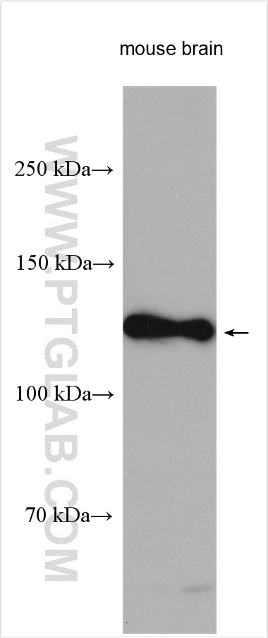 WB analysis using 10062-2-AP