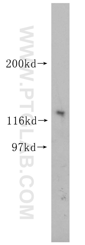 mouse Notch1 Polyclonal antibody