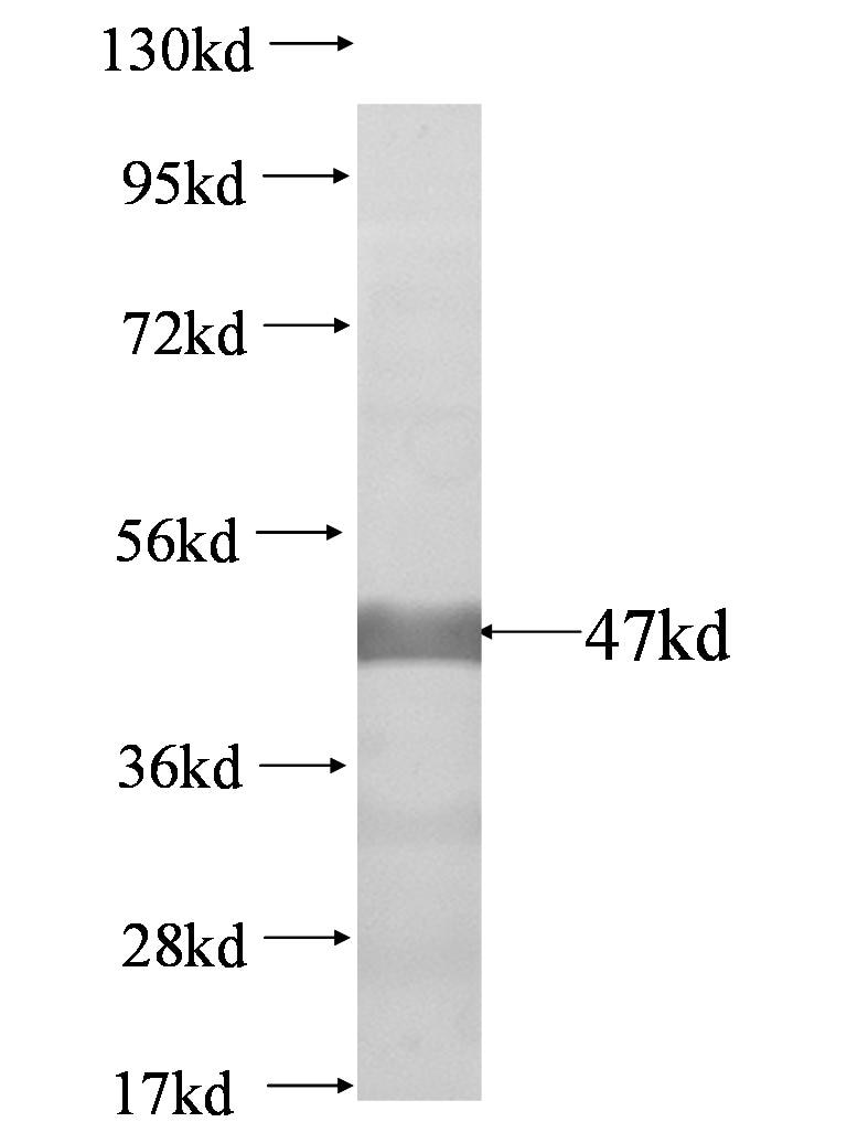 Nphs1 fusion protein Ag0641 SDS-PAGE