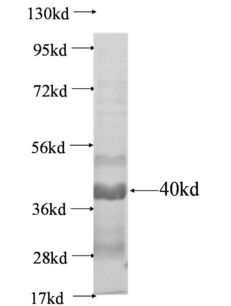 Nphs1 fusion protein Ag0642 SDS-PAGE