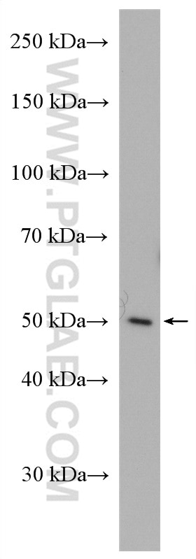 Western Blot (WB) analysis of HEK-293T cells using NUCB2/nesfatin-1 Polyclonal antibody (26712-1-AP)