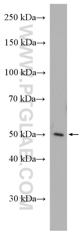 Western Blot (WB) analysis of HEK-293T cells using NUCB2/nesfatin-1 Polyclonal antibody (26712-1-AP)