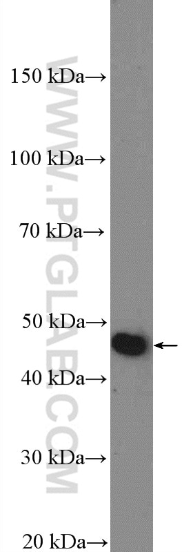 Western Blot (WB) analysis of rat brain tissue using NUCB2/nesfatin-1 Polyclonal antibody (26712-1-AP)