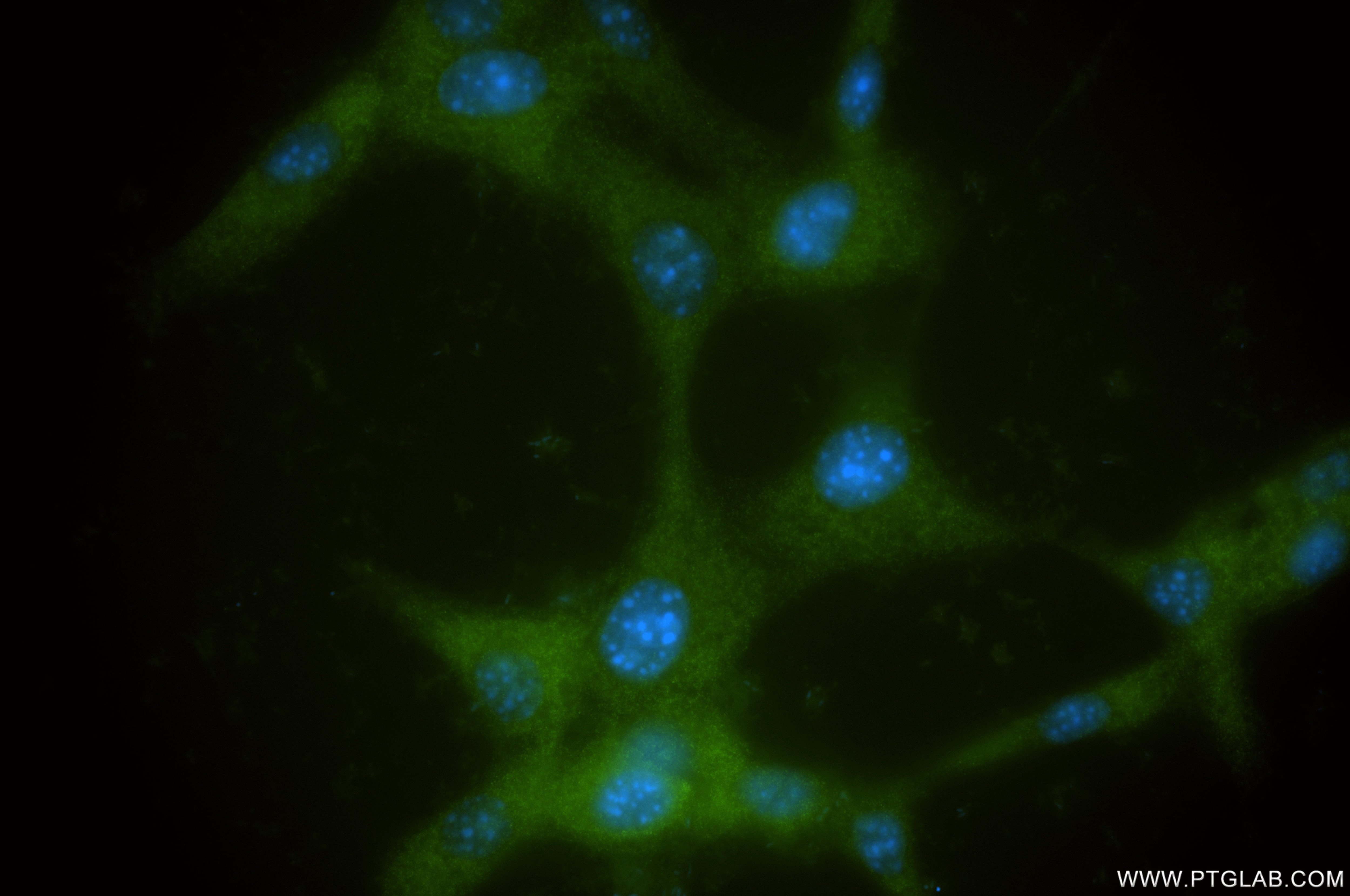 IF Staining of NIH/3T3 using 86651-1-RR Immunofluorescence (IF) / fluorescent staining of NIH/3T3 cells using Nucleoside phosphorylase Recombinant monoclonal an (86651-1-RR)
