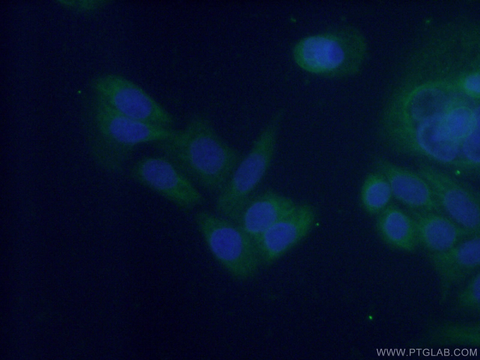Immunofluorescence (IF) / fluorescent staining of HeLa cells using NUDCD3 Polyclonal antibody (11764-1-AP)