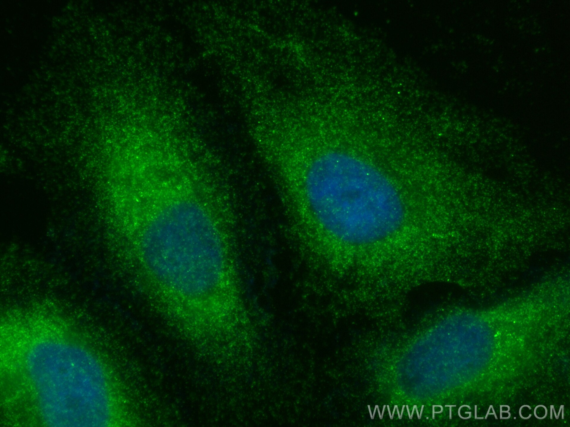 Immunofluorescence (IF) / fluorescent staining of HeLa cells using NUDCD3 Polyclonal antibody (11764-1-AP)