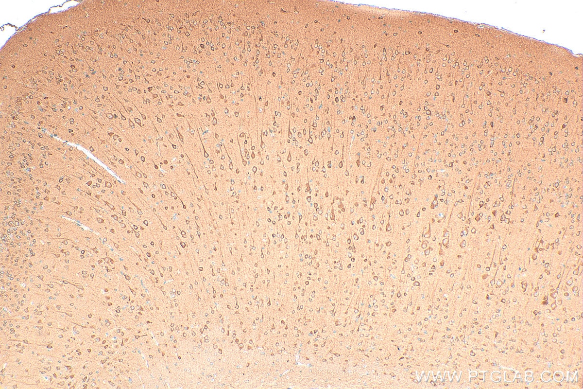 Immunohistochemistry (IHC) staining of mouse brain tissue using NUDCD3 Polyclonal antibody (11764-1-AP)