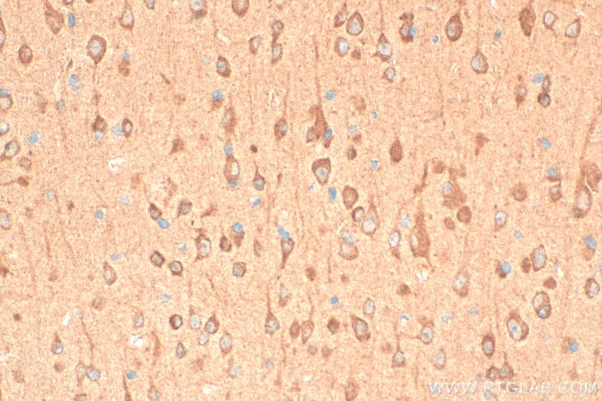 Immunohistochemistry (IHC) staining of mouse brain tissue using NUDCD3 Polyclonal antibody (11764-1-AP)