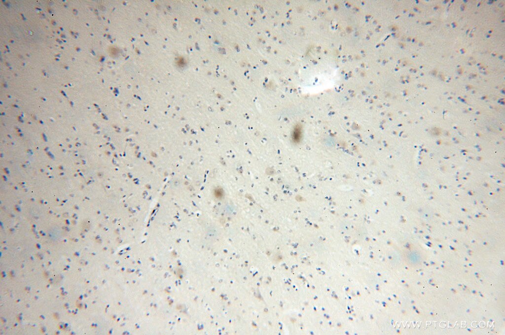 Immunohistochemistry (IHC) staining of human brain tissue using NUDCD3 Polyclonal antibody (11764-1-AP)