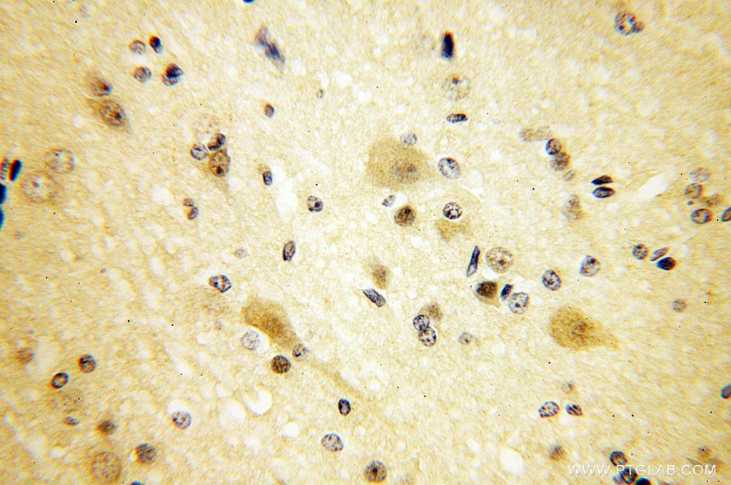 Immunohistochemistry (IHC) staining of human brain tissue using NUDCD3 Polyclonal antibody (11764-1-AP)