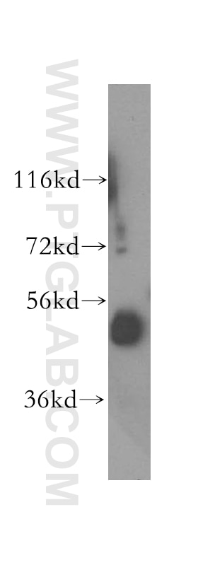 Western Blot (WB) analysis of human brain tissue using NUDCD3 Polyclonal antibody (11764-1-AP)