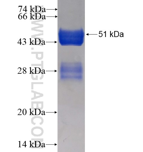NudCL fusion protein Ag2362 SDS-PAGE