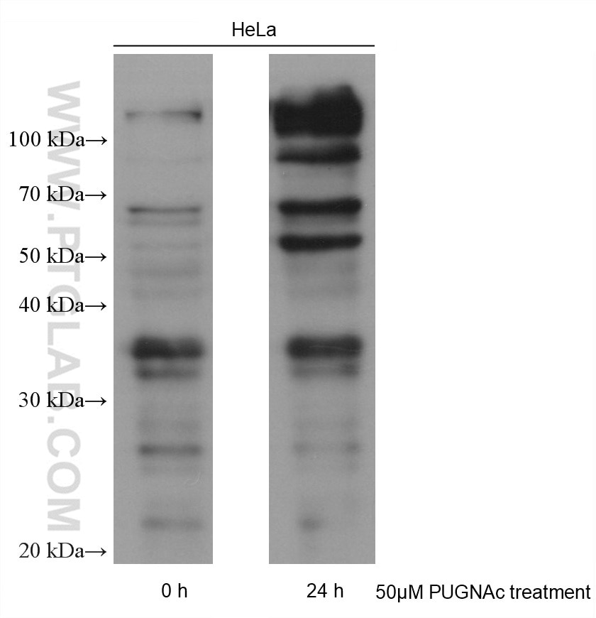 Western Blot (WB) analysis of various lysates using O-GlcNAc Monoclonal antibody (65292-1-Ig)