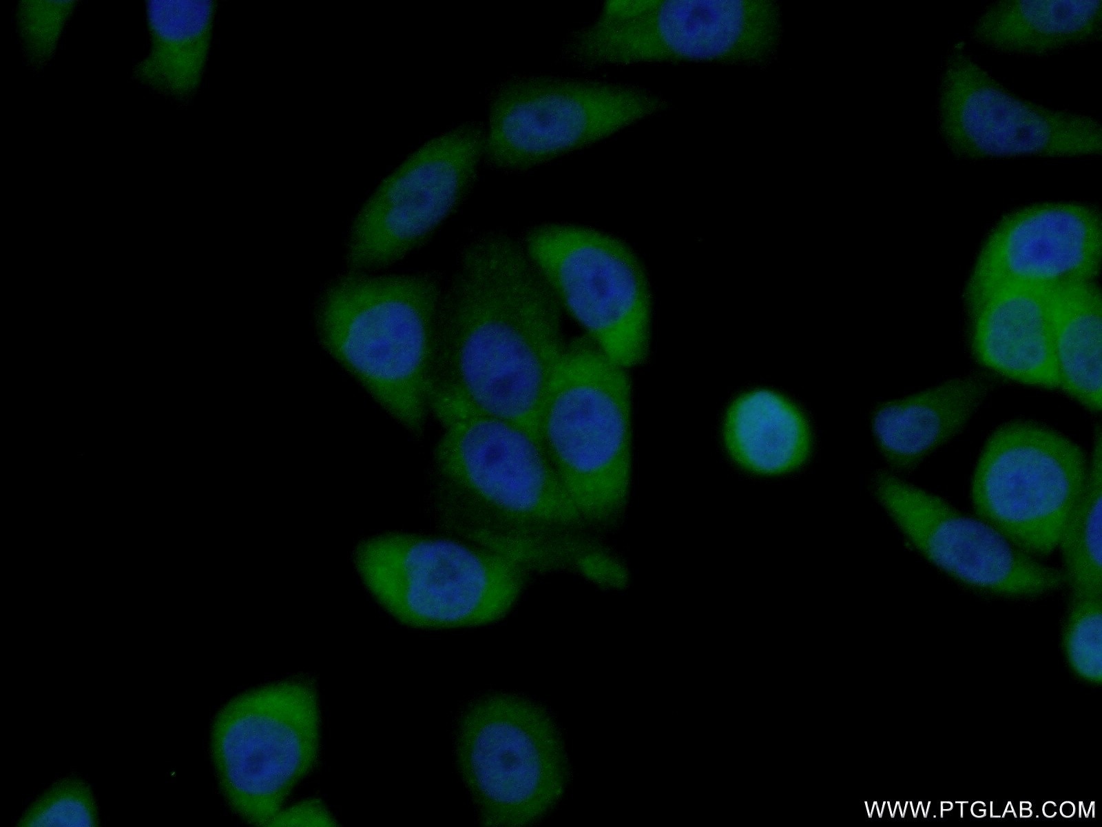 Immunofluorescence (IF) / fluorescent staining of HeLa cells using OAS1/3 Polyclonal antibody (14955-1-AP)