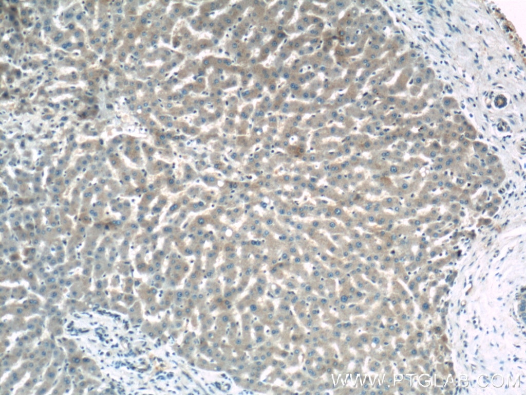 Immunohistochemistry (IHC) staining of human liver tissue using OAS1/3 Polyclonal antibody (14955-1-AP)