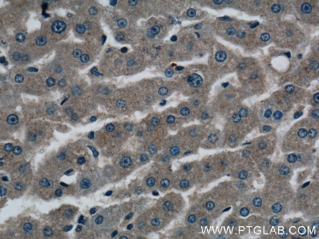 Immunohistochemistry (IHC) staining of human liver tissue using OAS1/3 Polyclonal antibody (14955-1-AP)