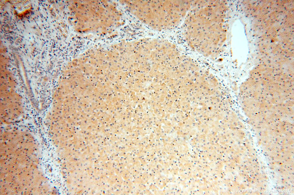 Immunohistochemistry (IHC) staining of human liver tissue using OAS1/3 Polyclonal antibody (14955-1-AP)