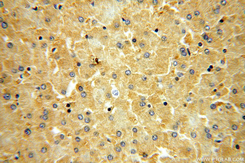 Immunohistochemistry (IHC) staining of human liver tissue using OAS1/3 Polyclonal antibody (14955-1-AP)