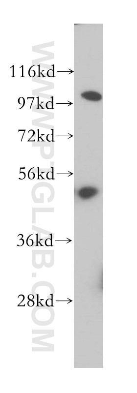 Western Blot (WB) analysis of HeLa cells using OAS1 Polyclonal antibody (14955-1-AP)