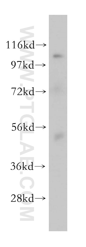 Western Blot (WB) analysis of mouse brain tissue using OAS1/3 Polyclonal antibody (14955-1-AP)