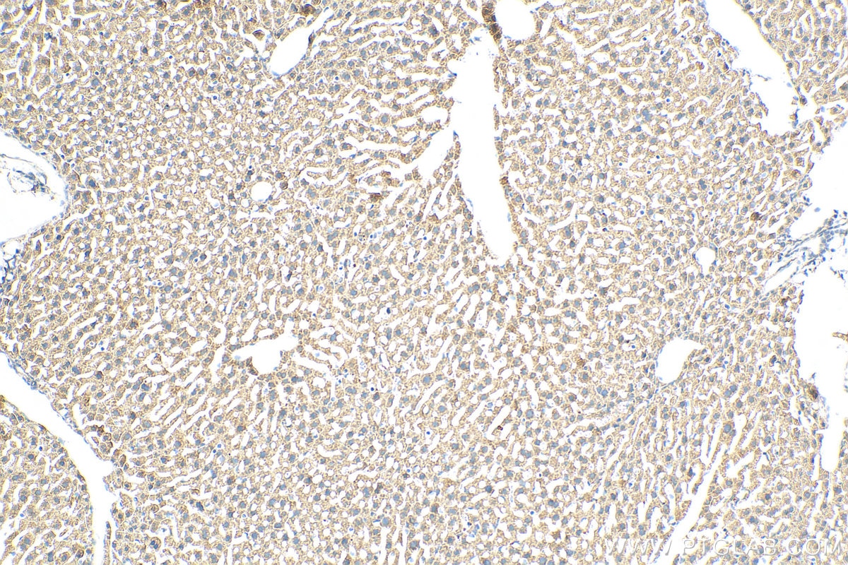 Immunohistochemistry (IHC) staining of mouse liver tissue using OAS1 Recombinant antibody (82883-1-RR)