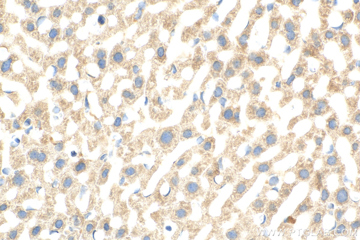 Immunohistochemistry (IHC) staining of mouse liver tissue using OAS1 Recombinant antibody (82883-1-RR)