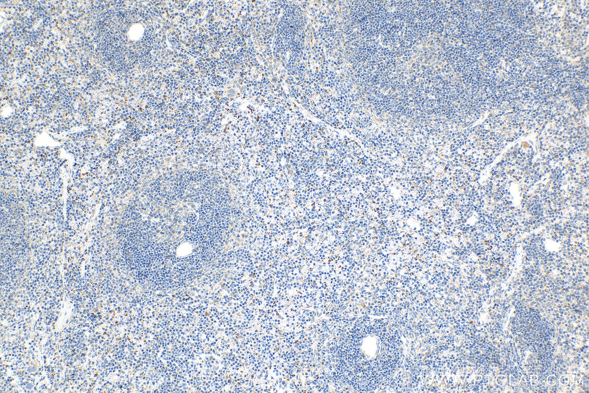 Immunohistochemistry (IHC) staining of mouse spleen tissue using OAS1 Recombinant antibody (82883-1-RR)