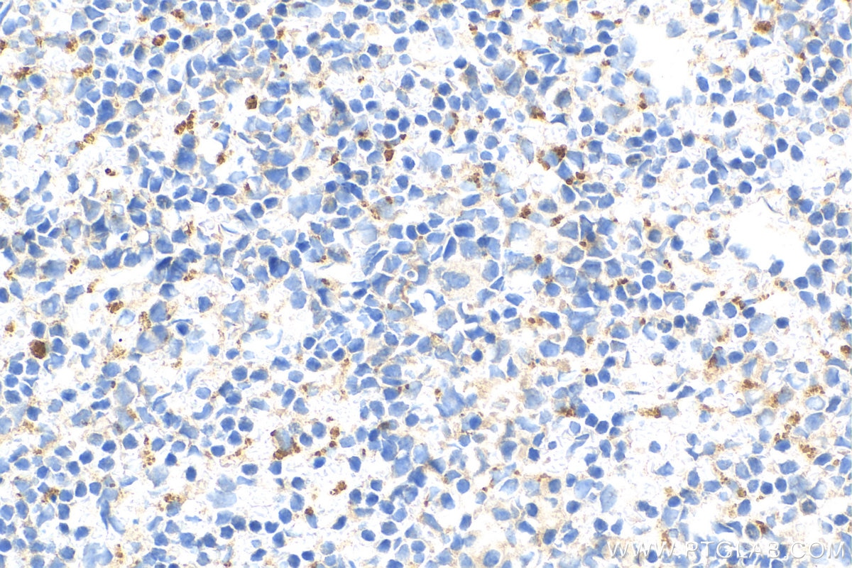 Immunohistochemistry (IHC) staining of mouse spleen tissue using OAS1 Recombinant antibody (82883-1-RR)