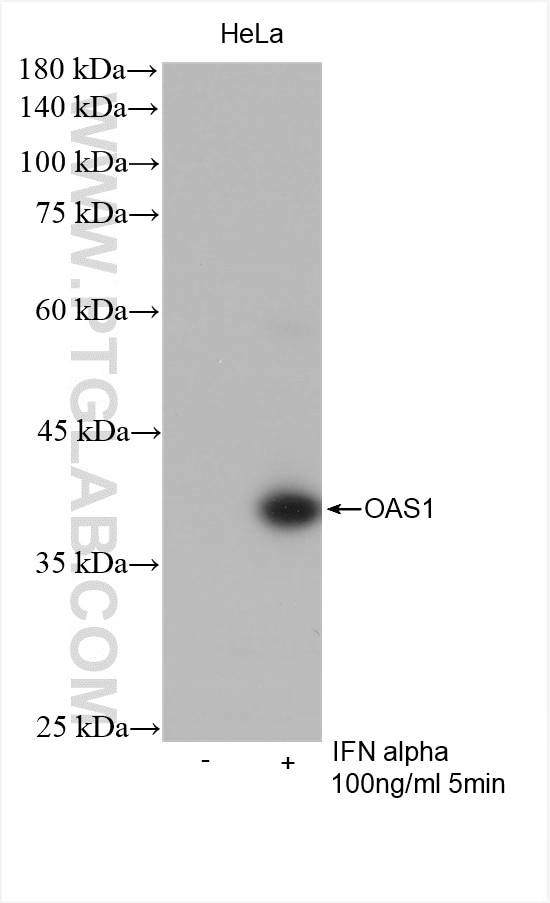 Western Blot (WB) analysis of various lysates using OAS1 Recombinant antibody (82883-1-RR)