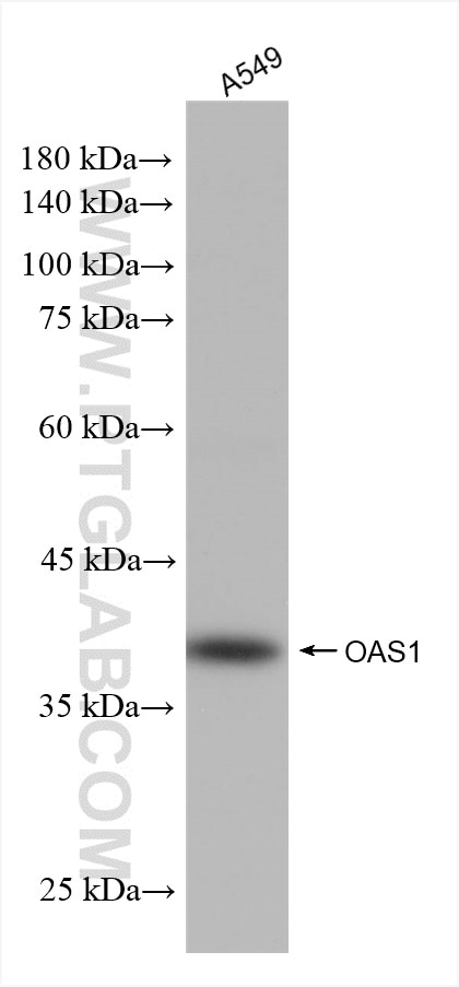 Western Blot (WB) analysis of A549 cells using OAS1 Recombinant antibody (82883-1-RR)