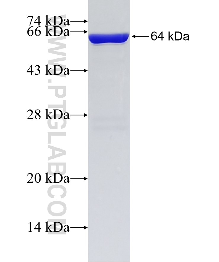 OAS1 fusion protein Ag6793 SDS-PAGE