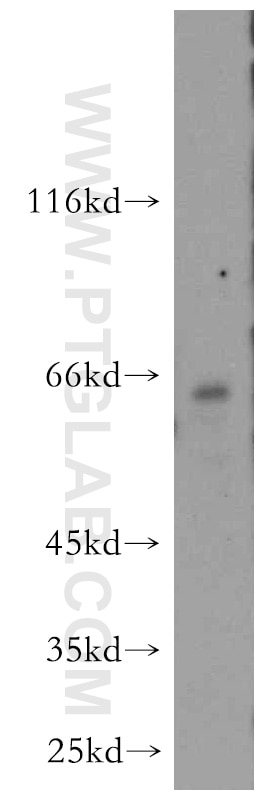 Western Blot (WB) analysis of Jurkat cells using OAS2 Polyclonal antibody (14214-1-AP)