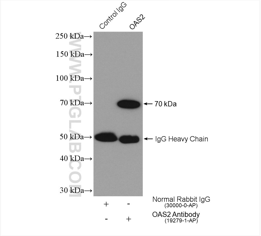 Immunoprecipitation (IP) experiment of Jurkat cells using OAS2 Polyclonal antibody (19279-1-AP)