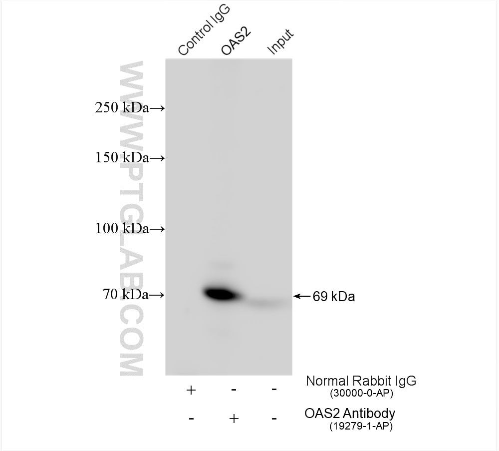Immunoprecipitation (IP) experiment of Jurkat cells using OAS2 Polyclonal antibody (19279-1-AP)