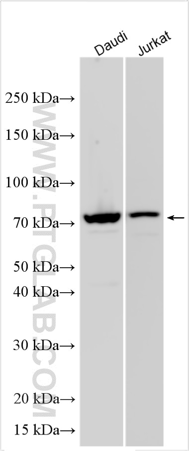 Western Blot (WB) analysis of various lysates using OAS2 Polyclonal antibody (19279-1-AP)
