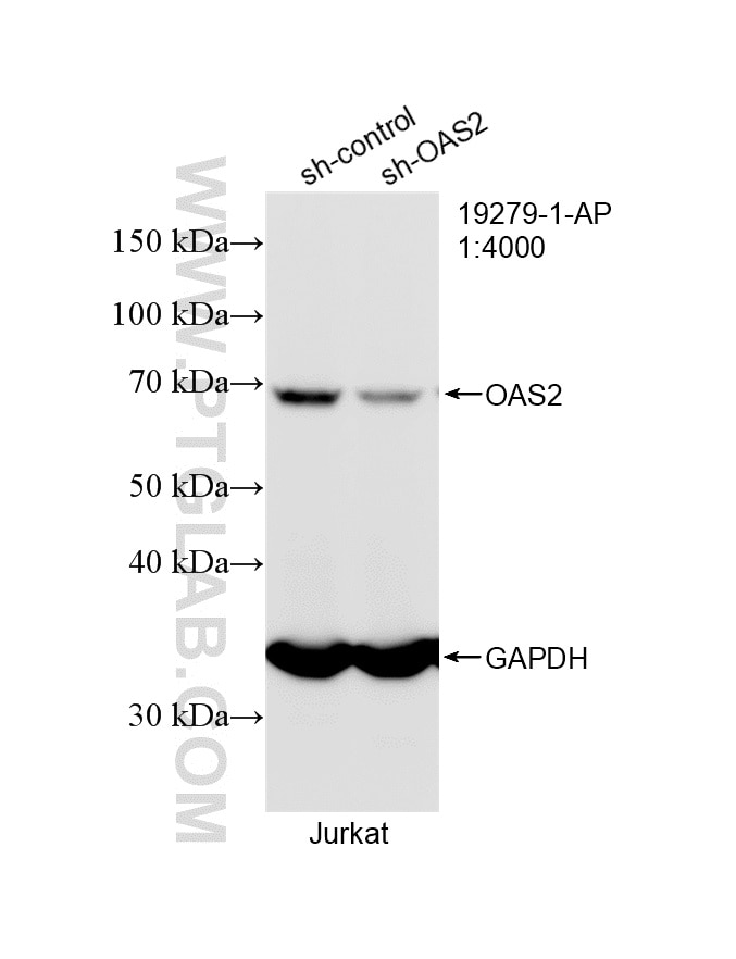 WB analysis of Jurkat using 19279-1-AP Western Blot (WB) analysis of Jurkat cells using OAS2 Polyclonal antibody (19279-1-AP)